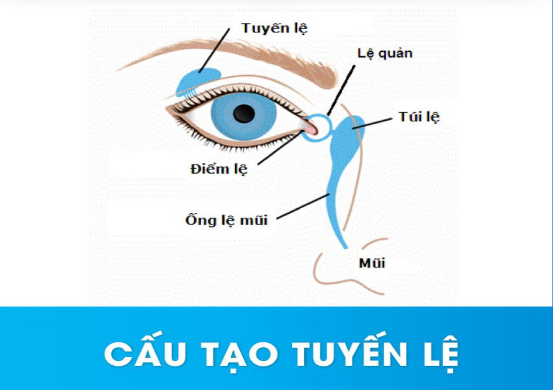 Cau-tao-tuyen-le