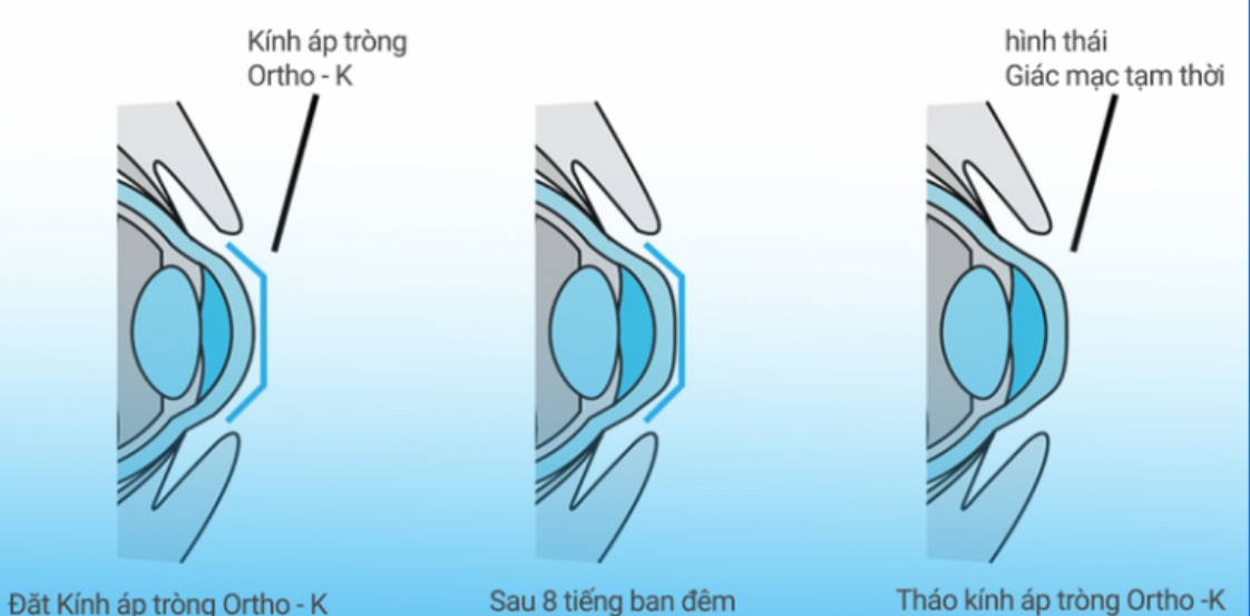 Co-che-cua-kinh-ap-trong-ban-dem