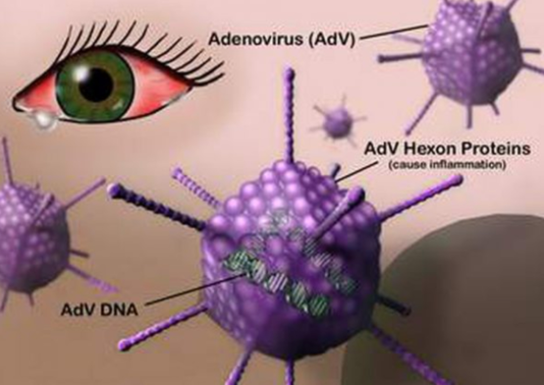 adenovirus-gay-viem-ket-mac-giac-mac