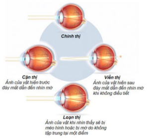 Co-che-tao-anh-cua-mat-chinh-thi-va-mat-co-tat-khuc-xa.