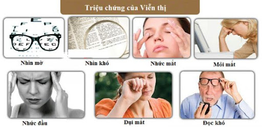 Dieu-tri-mat-vien-thi