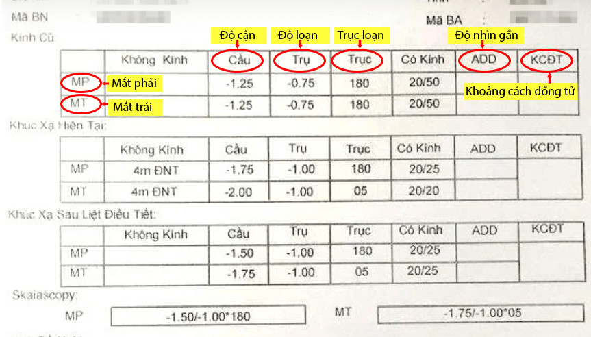 Cach-doc-do-can-tren-1-don-kinh-pho-bien